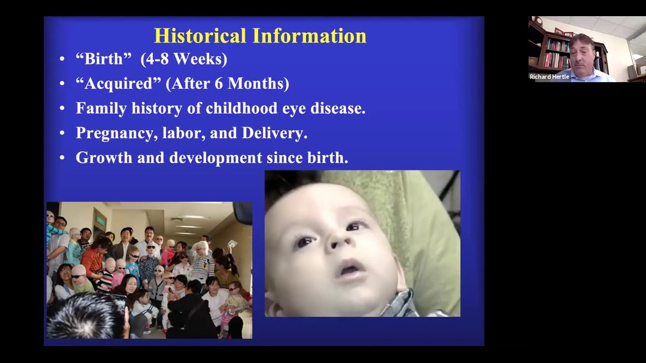 Paediatric Ophthalmology - Nystagmus in infancy and childhood