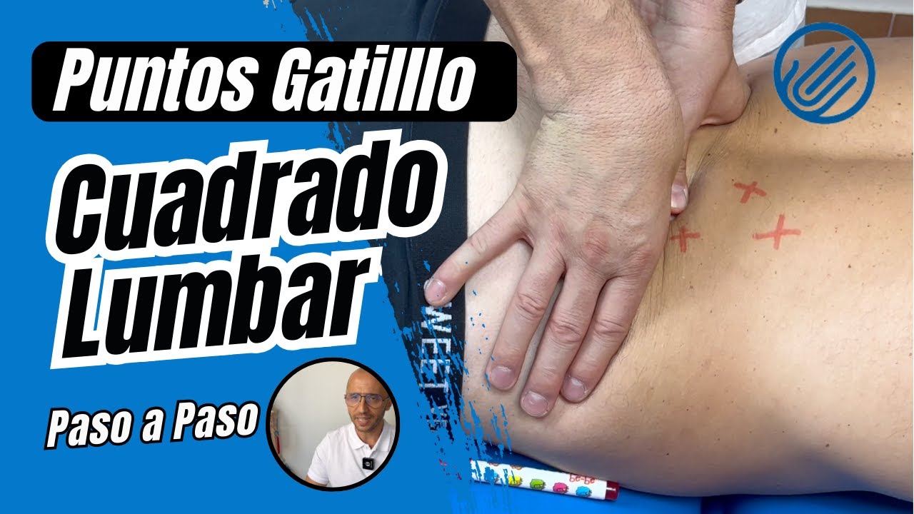 Puntos Gatillo Cuadrado Lumbar [Terapia MANUAL]