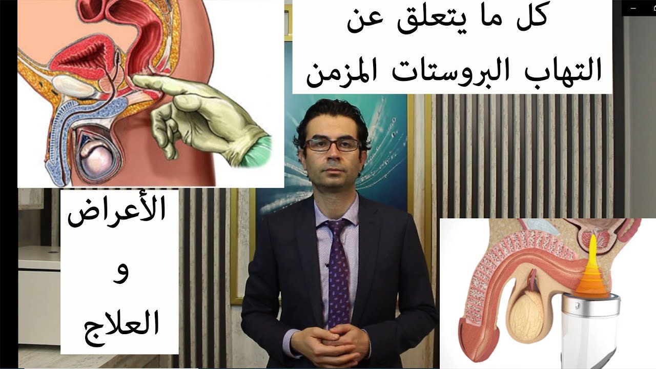 كل ما يتعلق عن التهاب البروستات المزمن / الأعراض والعلاج / الدكتور محسن بالابان
