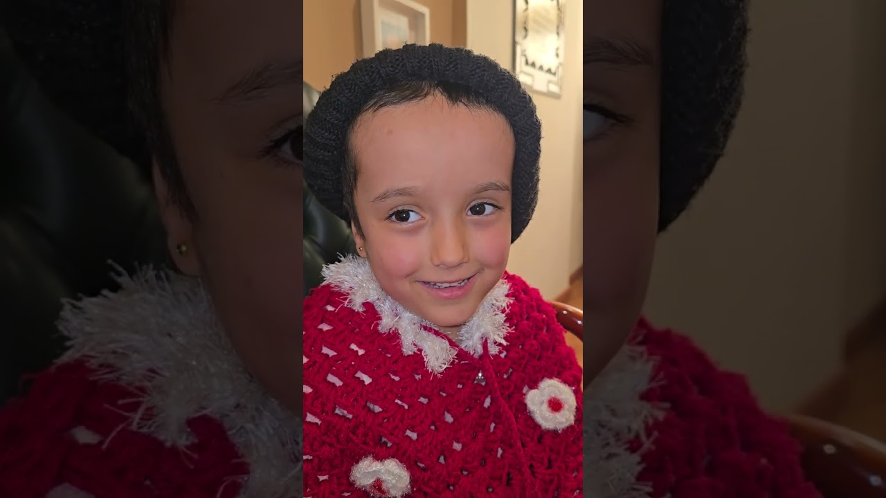 بدون صمام بعد سبع عمليات جراحيه على مدى اربع سنوات ثم ازاله صمامين من المخ وعمل جراحه كي الحنفيه