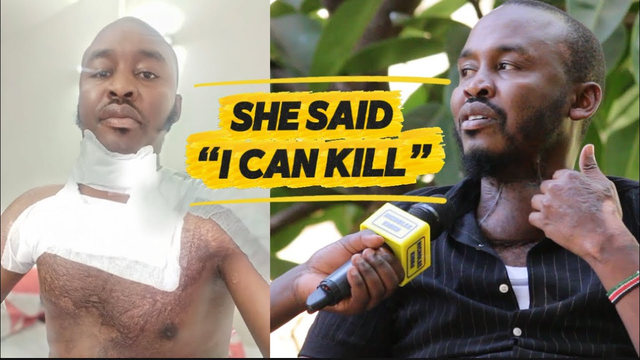 My Cheating Girlfriend Nearly Killed Me, She Set Me on Fire With Paraffin