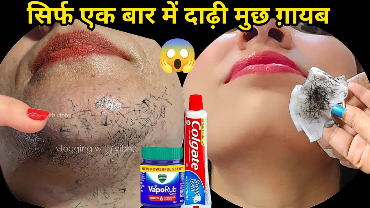 Vicks का ऐसा जादू👉लगते ही दाढ़ी मूछ गायब 😱अनचाहे बालों का समाधान || facial hair treatment in Hindi 