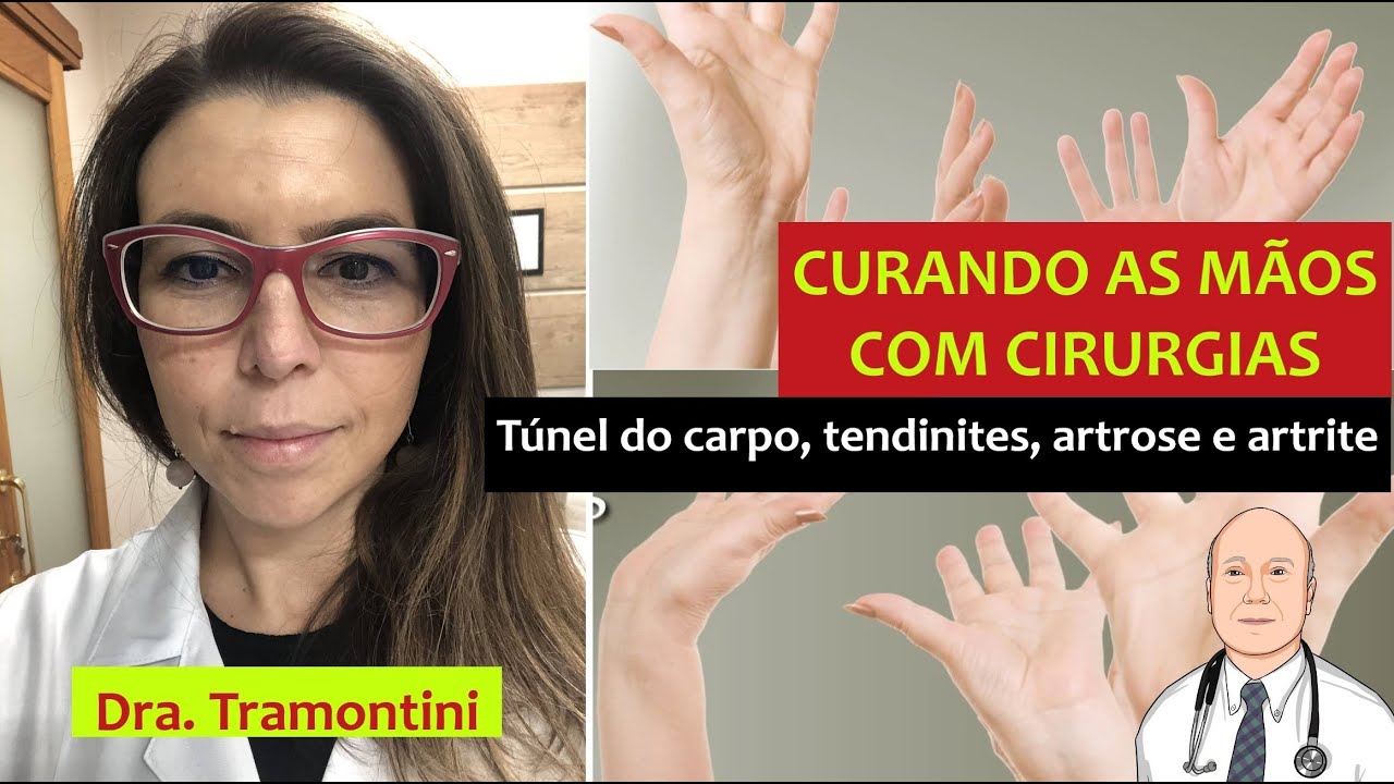 Os problemas das mãos que a cirurgia resolve: indicações, riscos e sucessos.