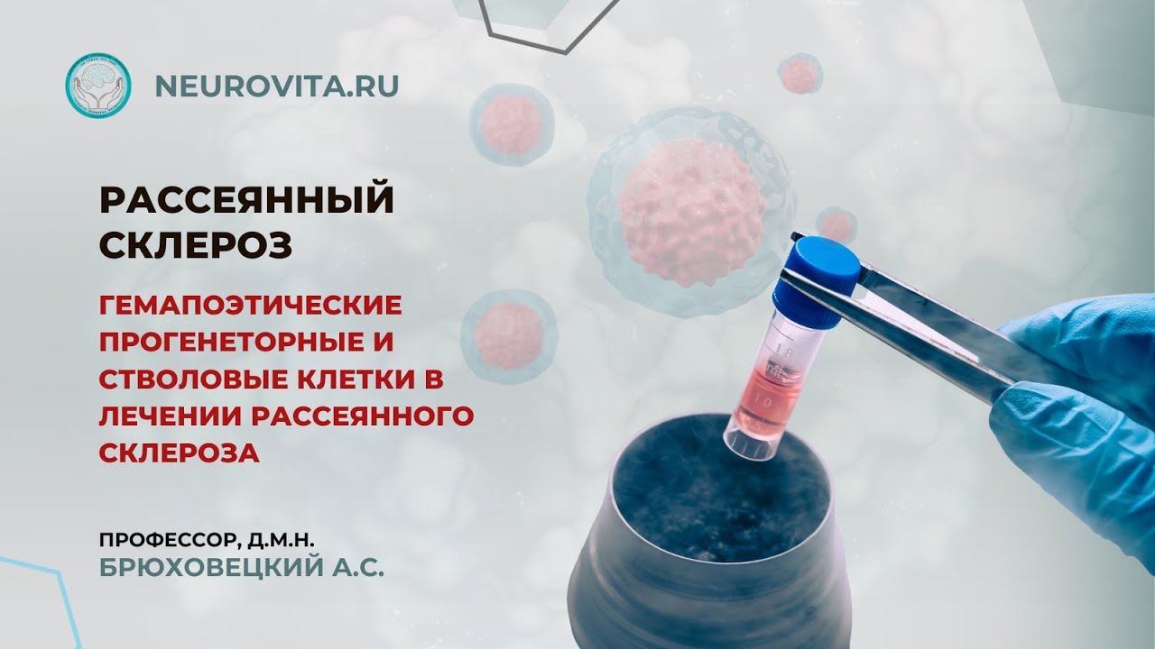 Рассеянный склероз. Гемапоэтические прогенеторные и стволовые клетки в лечении рассеянного склероза