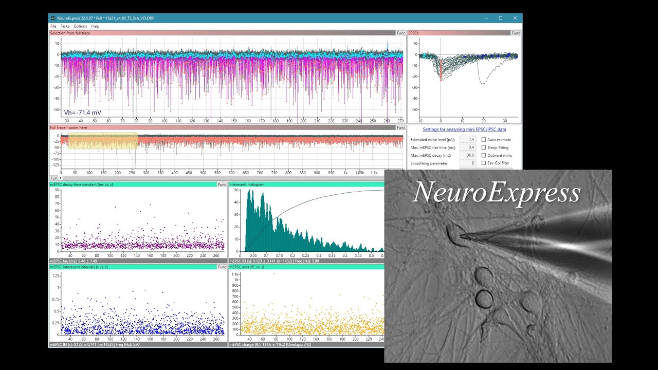 NeuroExpress Tutorial #2 - Mini Analysis