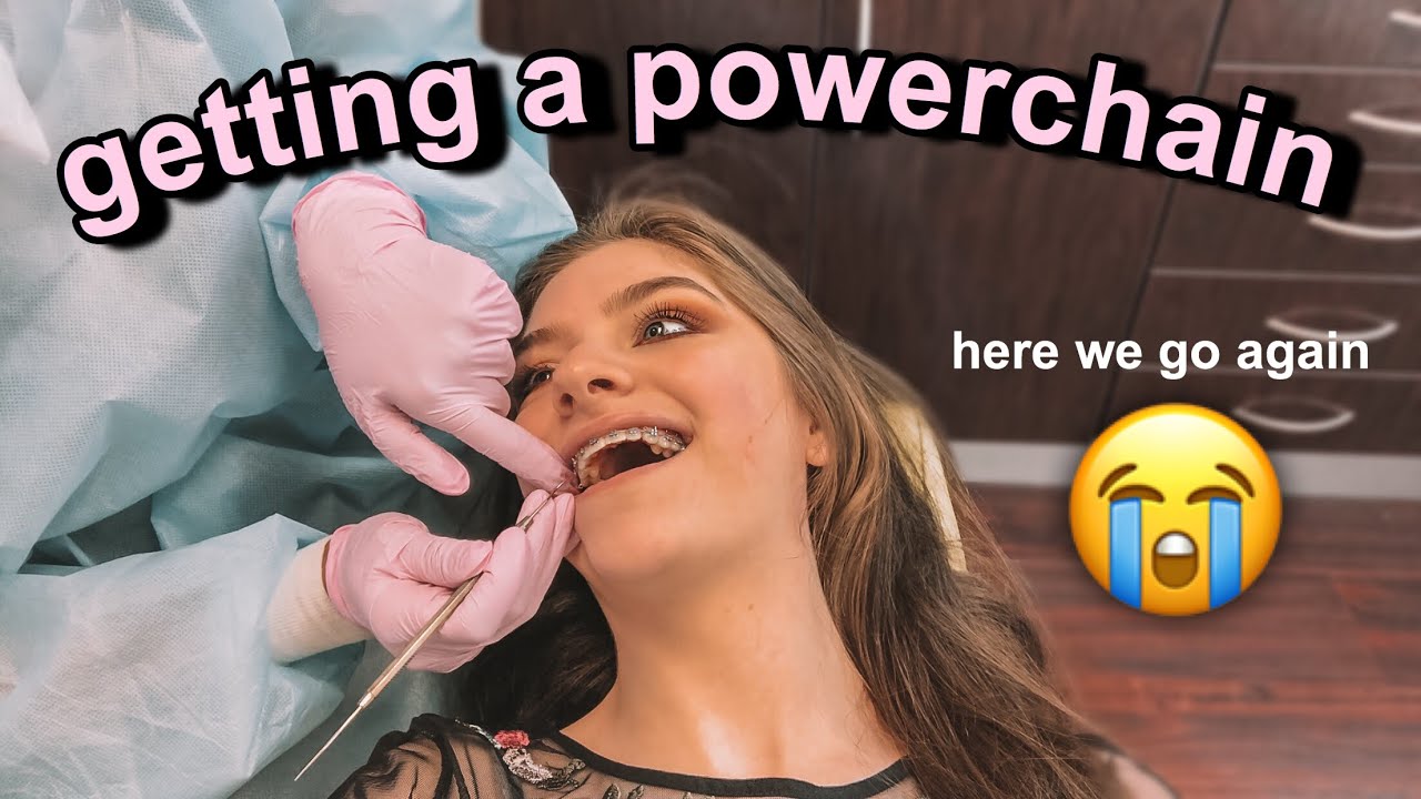 BRACES UPDATE: GETTING A POWERCHAIN !! | Lauren Hennessy