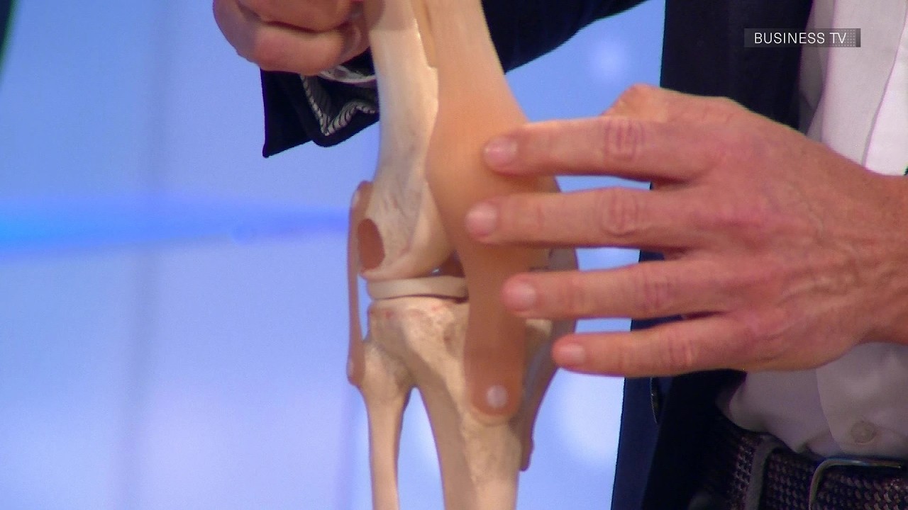 Seitenbandverletzung im Knie – Ursachen, Diagnose & moderne Therapie | Sportmedizin