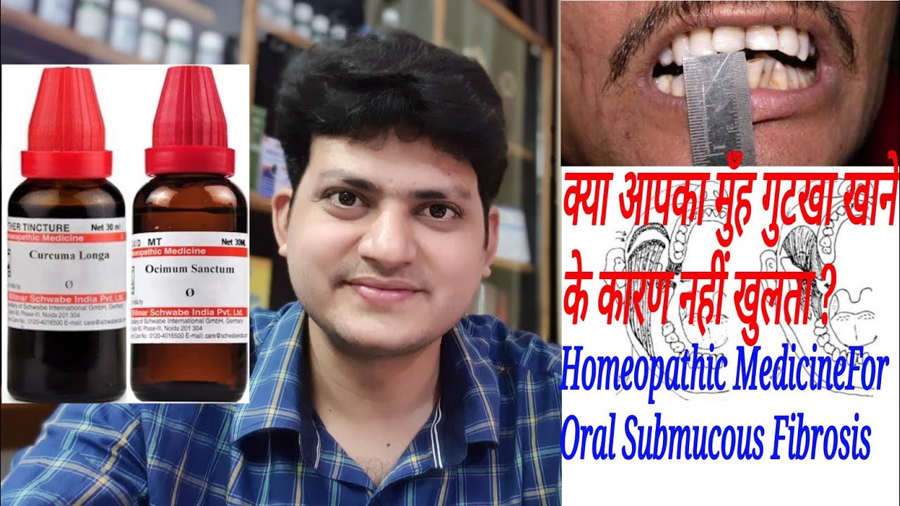 क्या आपका मुँह गुटखा खाने के कारण नहीं खुलता ? Homeopathic Medicine For Oral Submucous Fibrosis ?