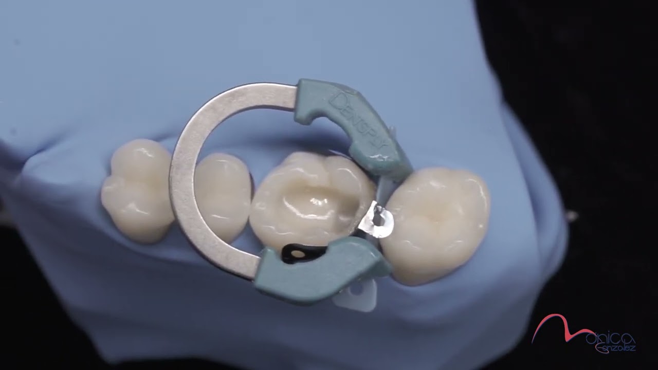 PALODENT V3
