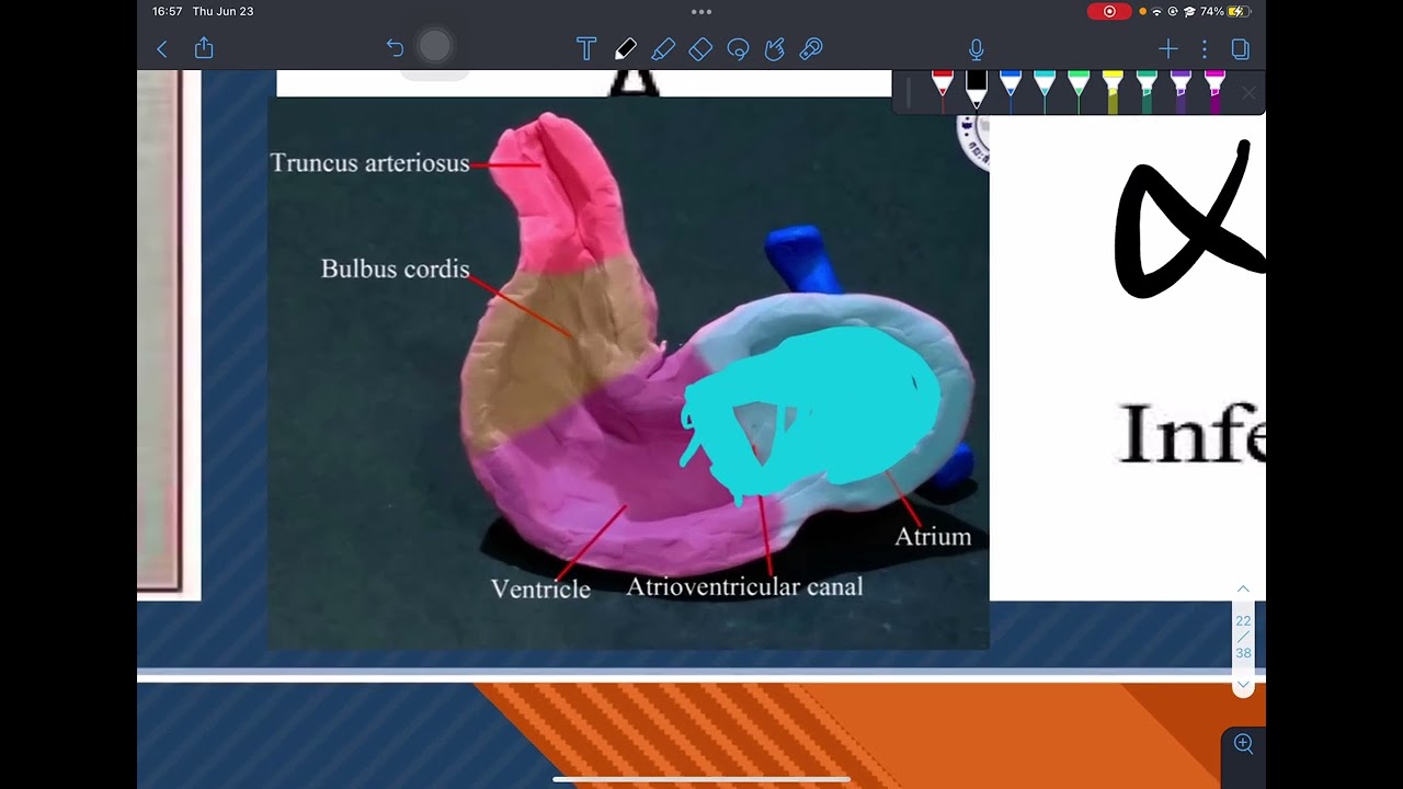 Formation of Heart Septa