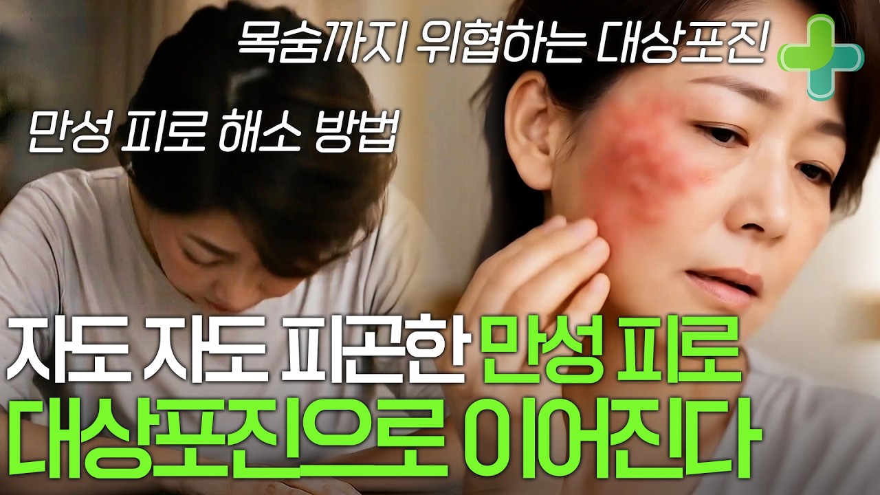 현대인의 고질병 만성 피로 대상포진의 시작이다? 만성 피로 근본 해결 방법