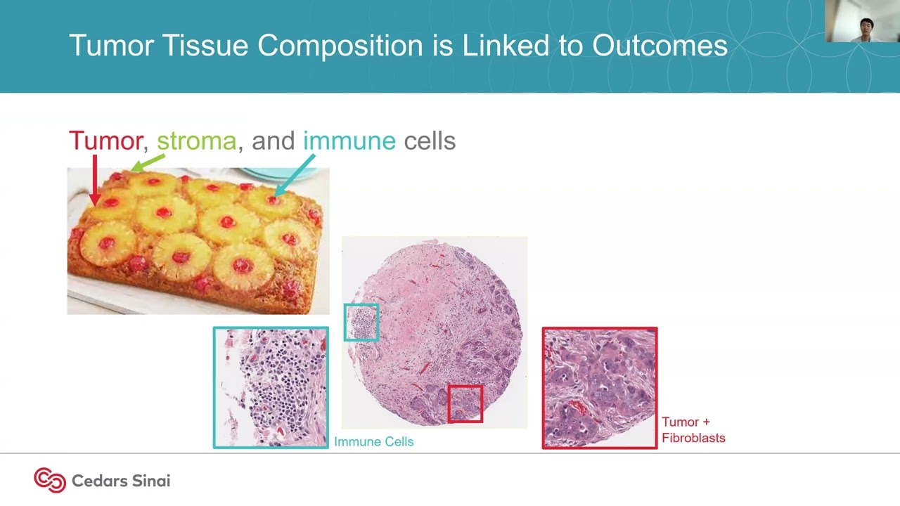Spatial Biology of Tumor Microenvironments for Clinical Biomarker Development and Therapy Prediction