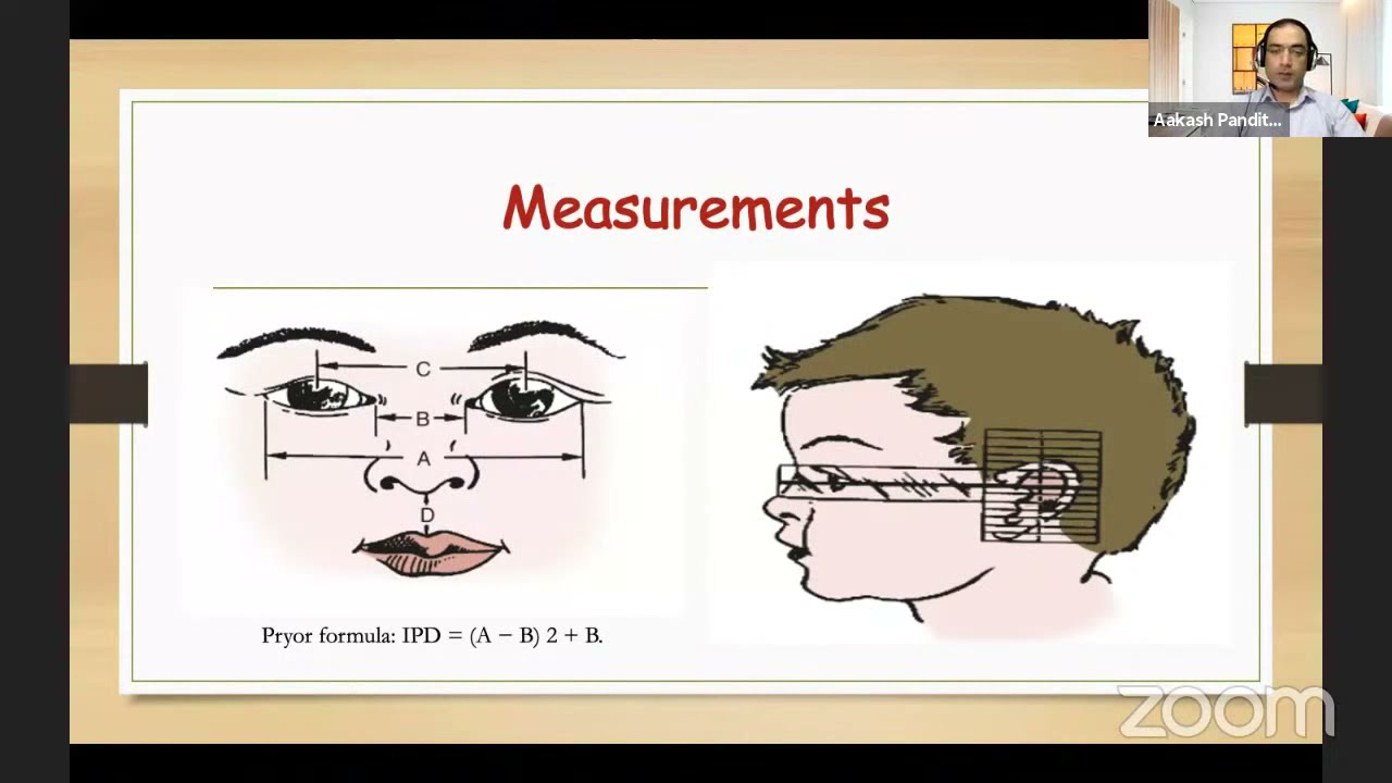 Approach to a neonate with dysmorphism