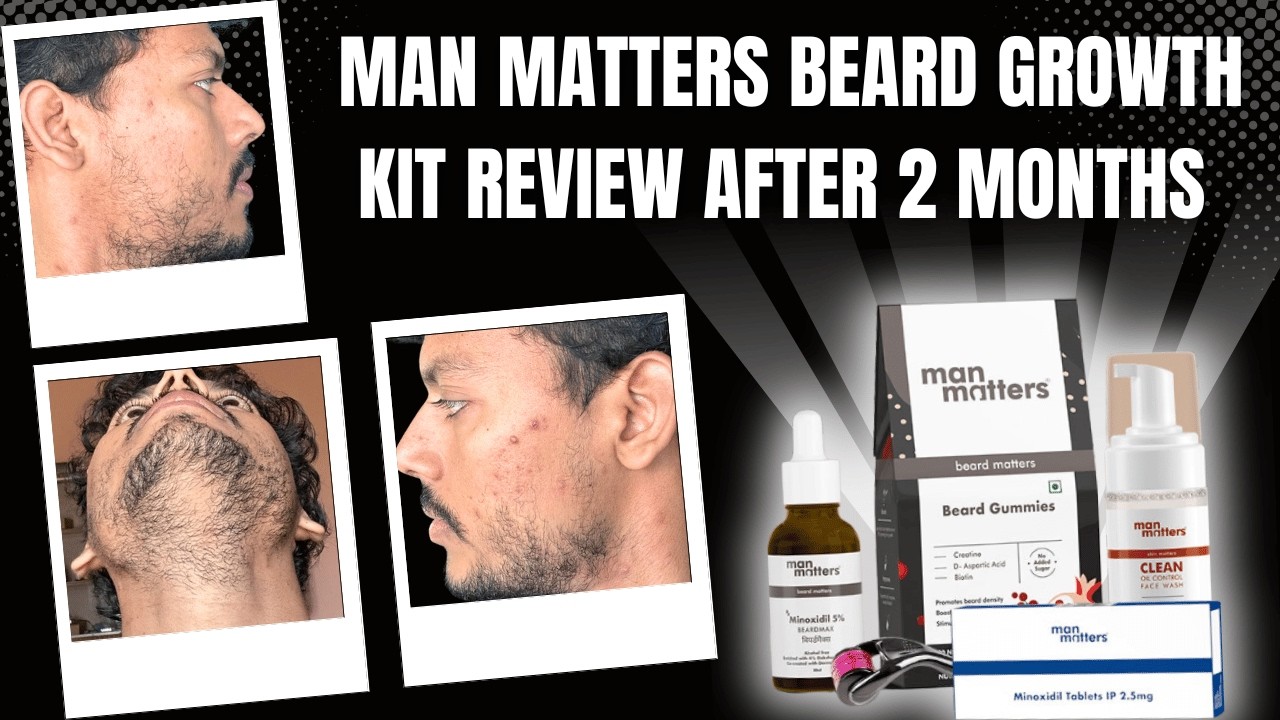Man Matters Beard Growth Kit Review 2 Months | How to Use Man Matters Beard Kit | Beard Growth Kit