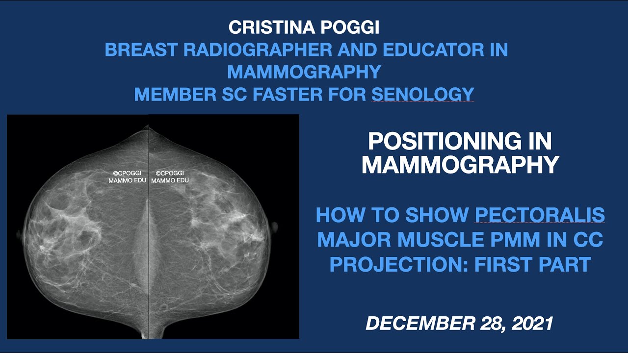 HOW TO SHOW PECTORALIS MAJOR MUSCLE IN CC PROJECTION: FIRST PART