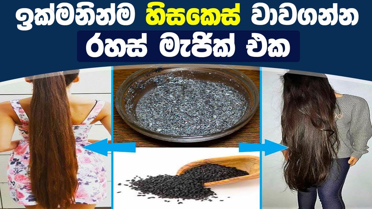ඉක්මනින්ම හිසකෙස් වාවගන්න රහස් මැජික් එක - 10 Tips to Naturally Regrow Your Hair