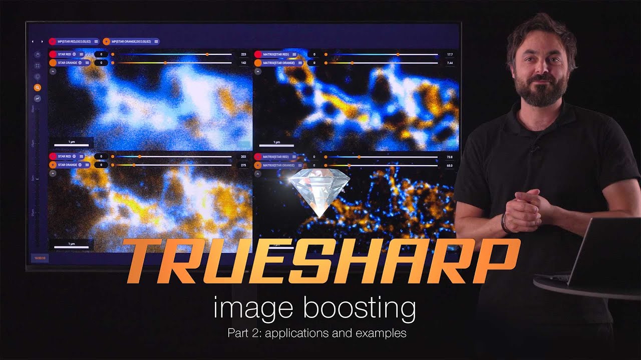 TRUESHARP image boosting – deconvolution you can trust! Part 2