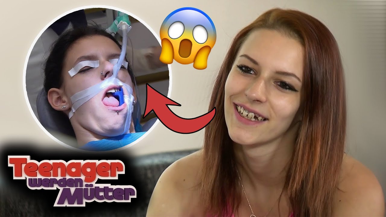 PANISCHE ANGST! 😱 Michelles Horror-OP ihrer Zähne 😲| Teenager werden Mütter | ATV