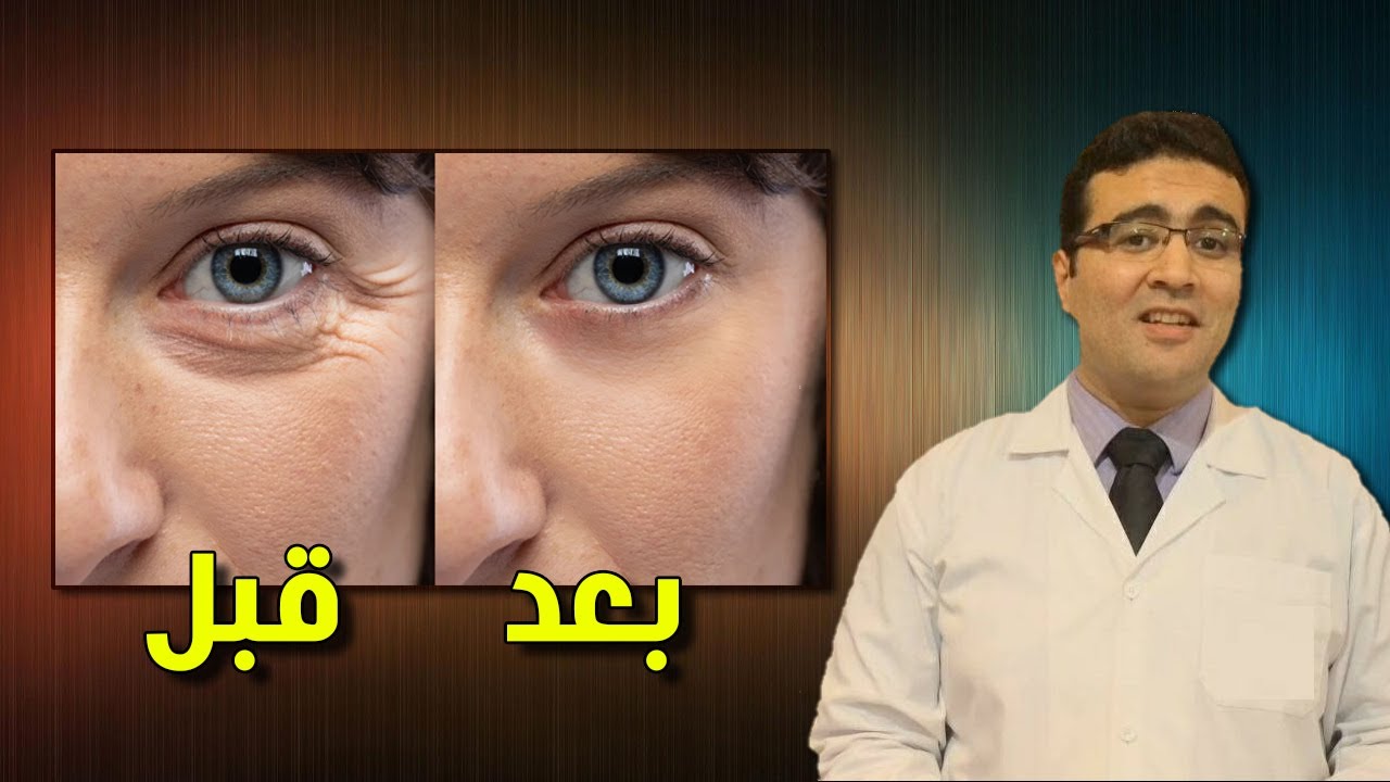 أقوى كريم لتجاعيد العين!