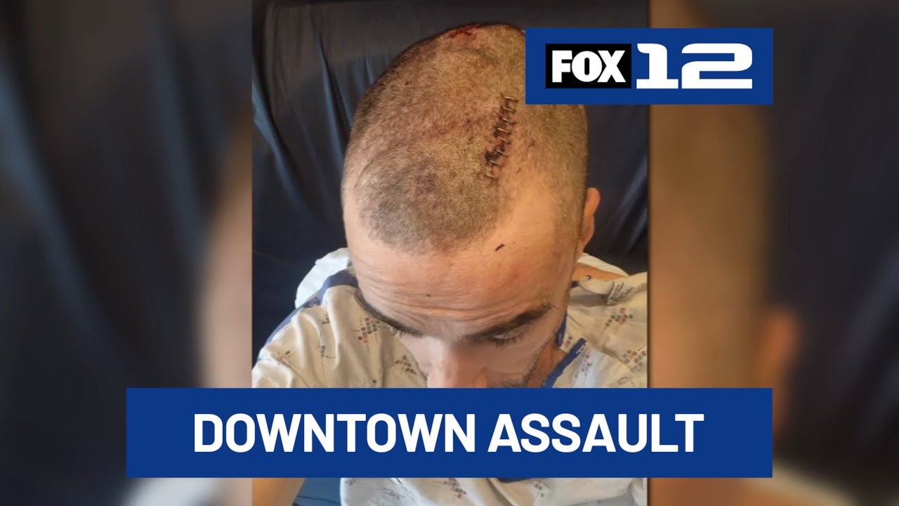 Security guard recovering from head injury after assault near the Downtown Central Library