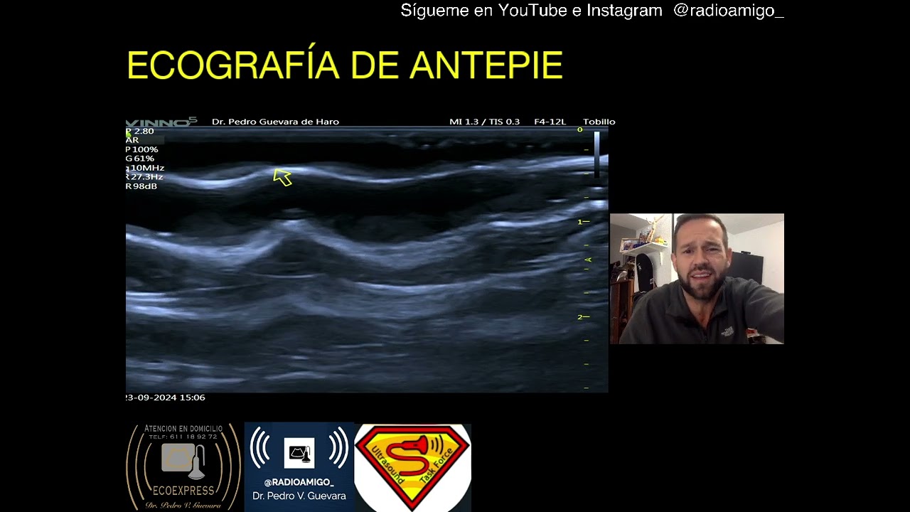 ECOGRAFIA  - REVISION DEL ANTEPIE (3/3)