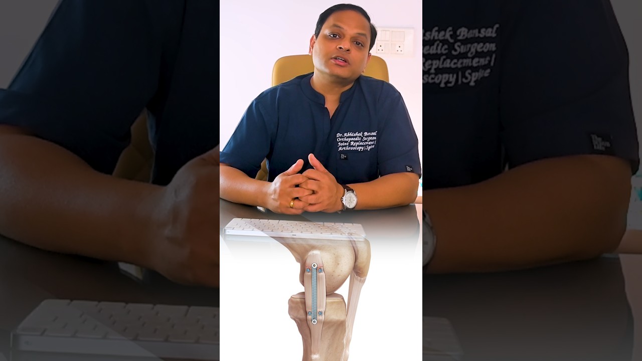 What is Internal Bracing in Acl Surgery and its benefits? #bracing #acltear #aclrecovery #surgeon