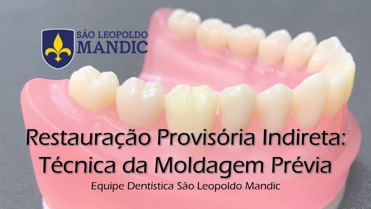 Restauração provisória indireta/ coroa provisória - técnica da moldagem prévia