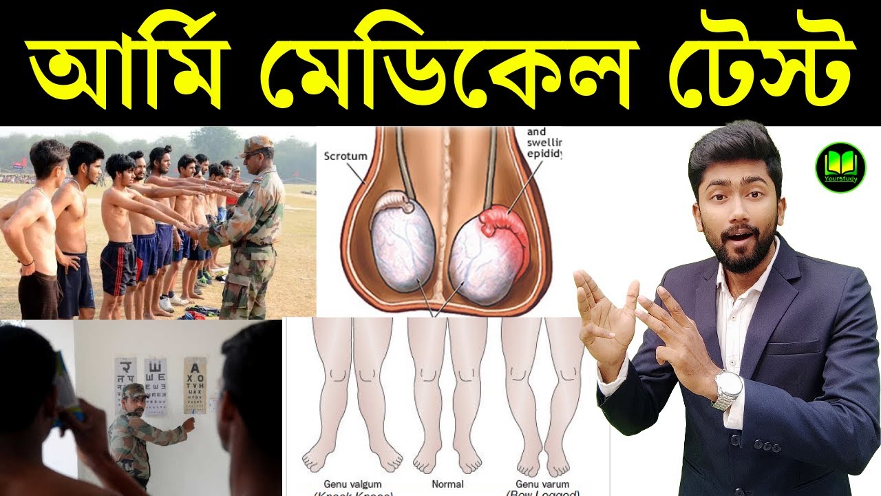 Medical Test of Indian Army in Bengali | Medical Test of Private Parts in Indian Army