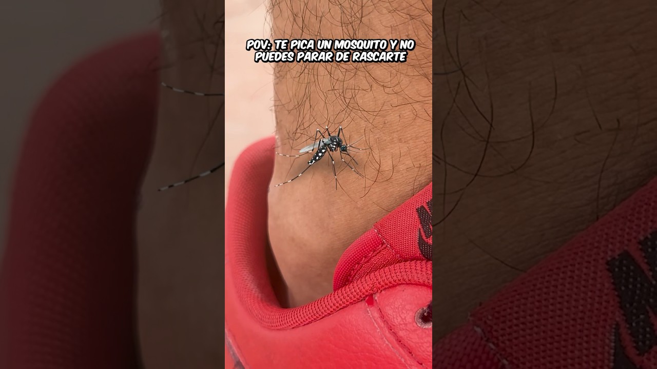 POV: Kiedy KOMAR cię ugryzie...🦟😡 #humor #komedia #kr&oacute;tkie metraże