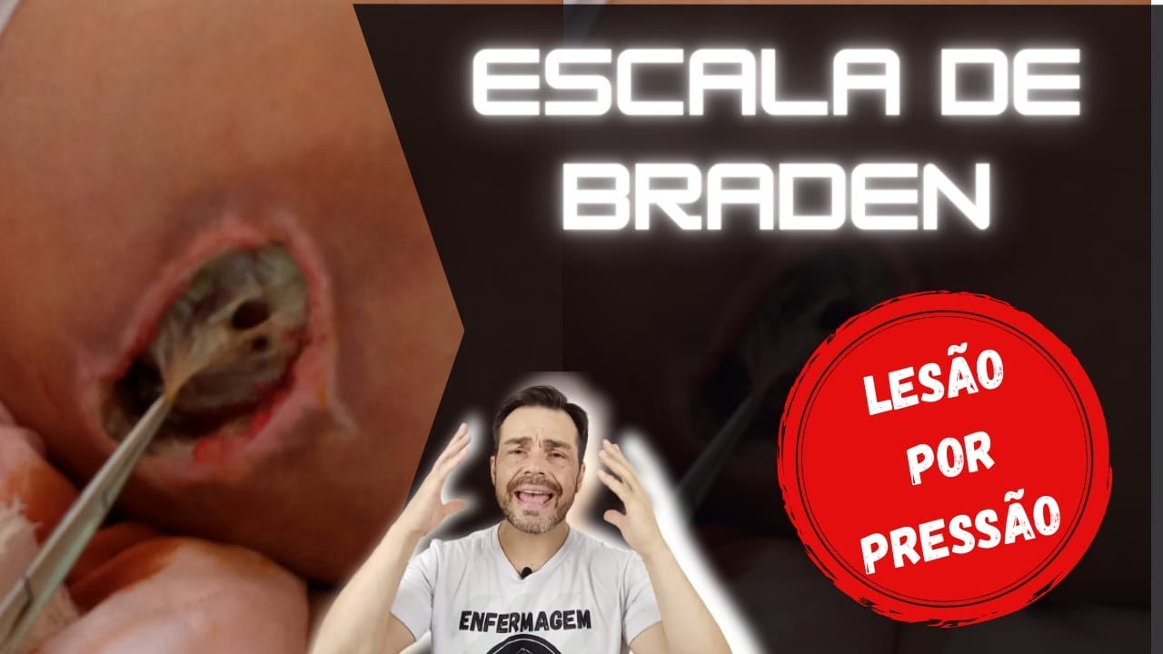 ESCALA DE BRADEN ENFERMAGEM - Como realizar a escala e avaliação