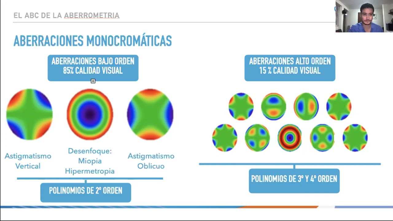 SESIÓN VIRTUAL CAPÍTULO CÓRNEA, CATARATA Y CIRUGÍA REFRACTIVA - DR. VICENTE MORIN- DRA. ISABEL GÓMEZ