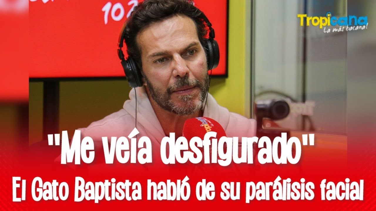 Juan Alfonso 'El Gato' Baptista reveló la causa de la parálisis facial que sufrió