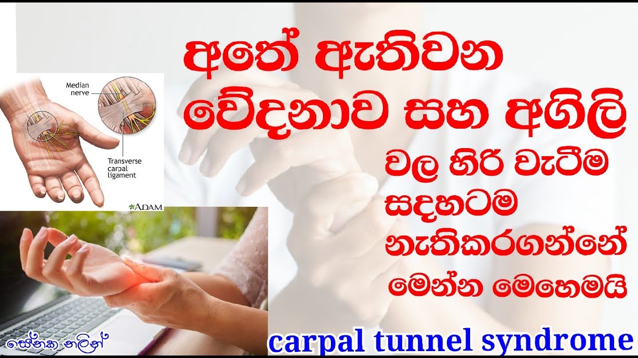 අතේ කැක්කුම... ඇගිලි හිරිවැටෙනවද..hand pain..atha kakkumata..agili hiriwatenawata...