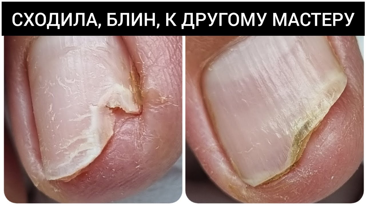 СХОДИЛА к ДРУГОМУ мастеру