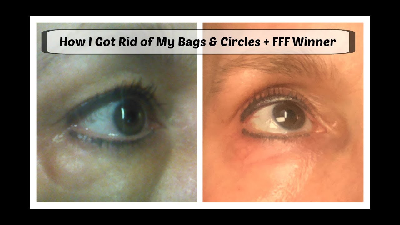 How I Got Rid of Eye Bags & Circles In My 60's + A 2nd FFF Winner