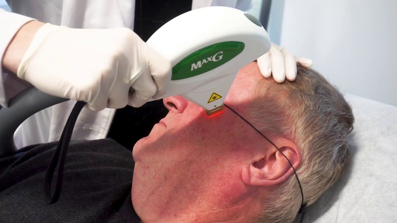 IPL For Broken Capillaries