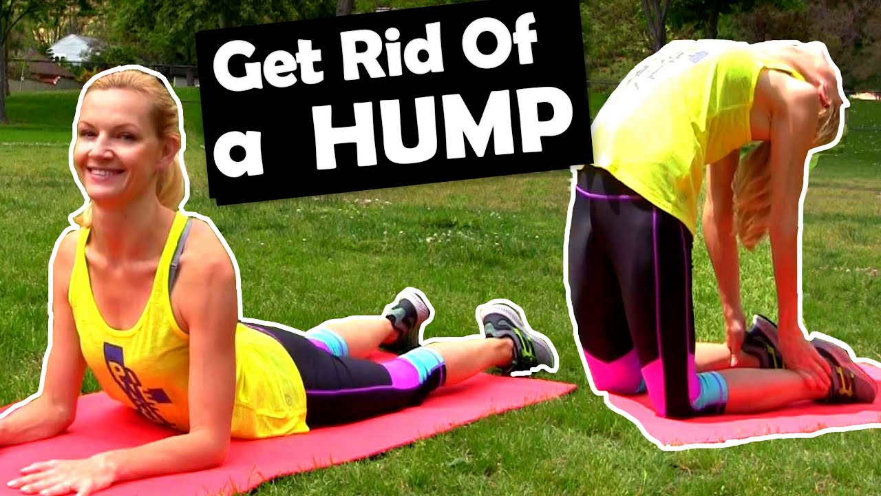 How to get Rid of A Hunchback/Dowagers Hump ★ Best Exercises to Fix Spine & Posture ♦ Get CONFIDENT!