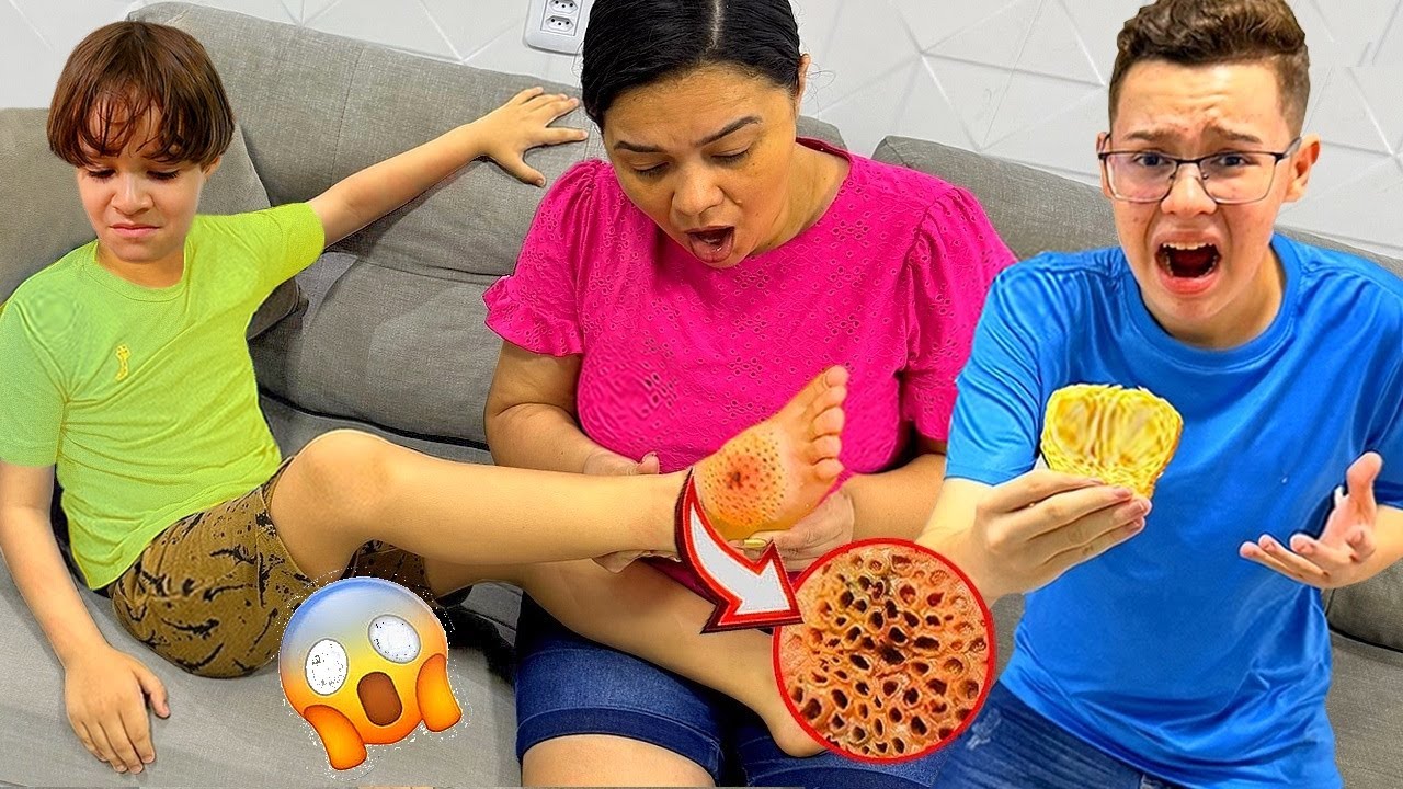 UM BICHO ESTRANHO PICOU O PÉ DO GABRIEL! Comeu comida estragada e outras Histórias!
