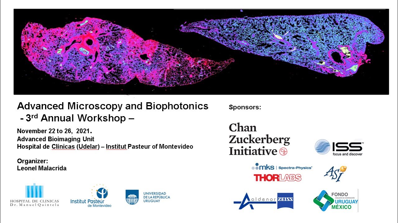Lecture 17  Per Niklas Hedde The single plane illumination microscopy and its
