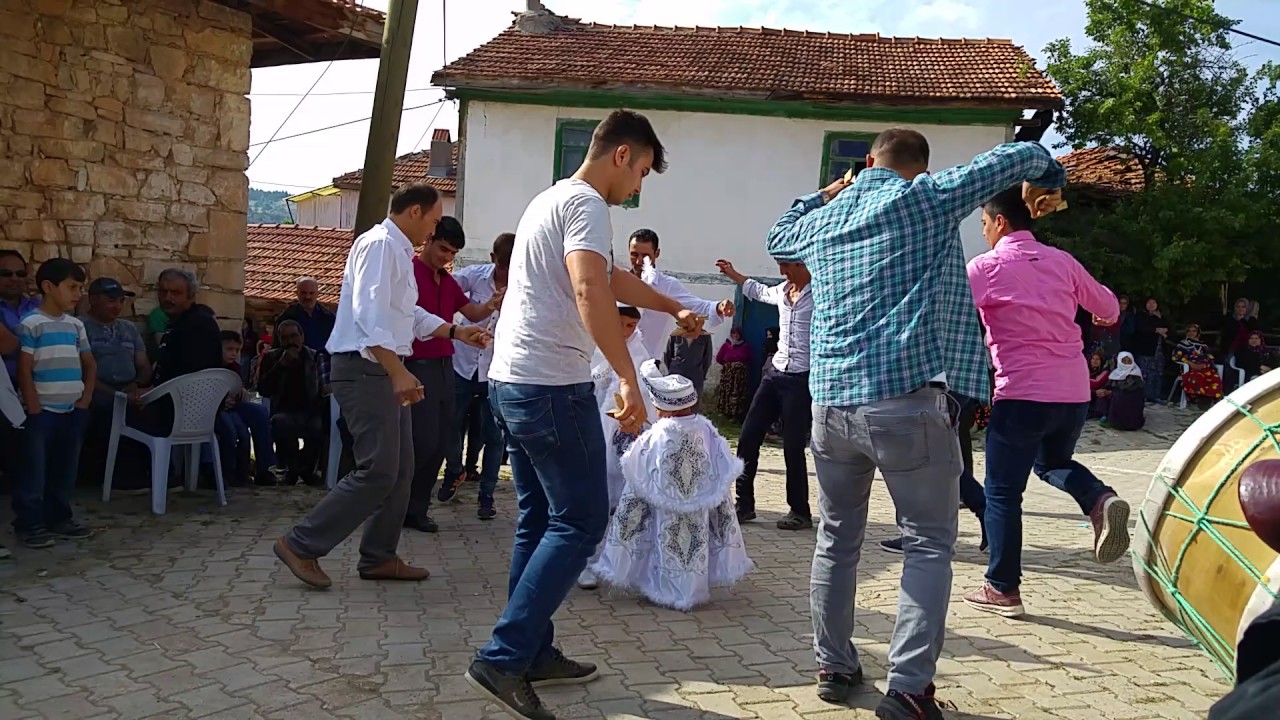 Sünnet düğünü