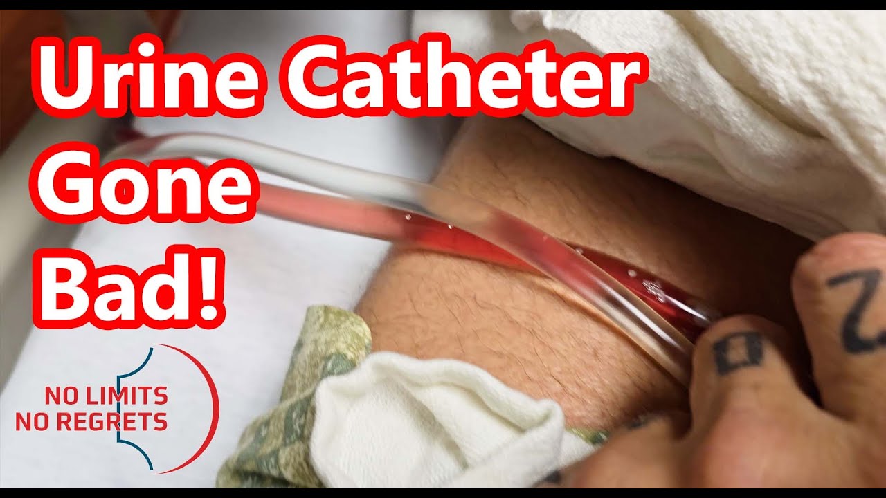 Urinary CATHETER PROBLEMS - Heart Surgery Gone Bad & Problem with Catheter