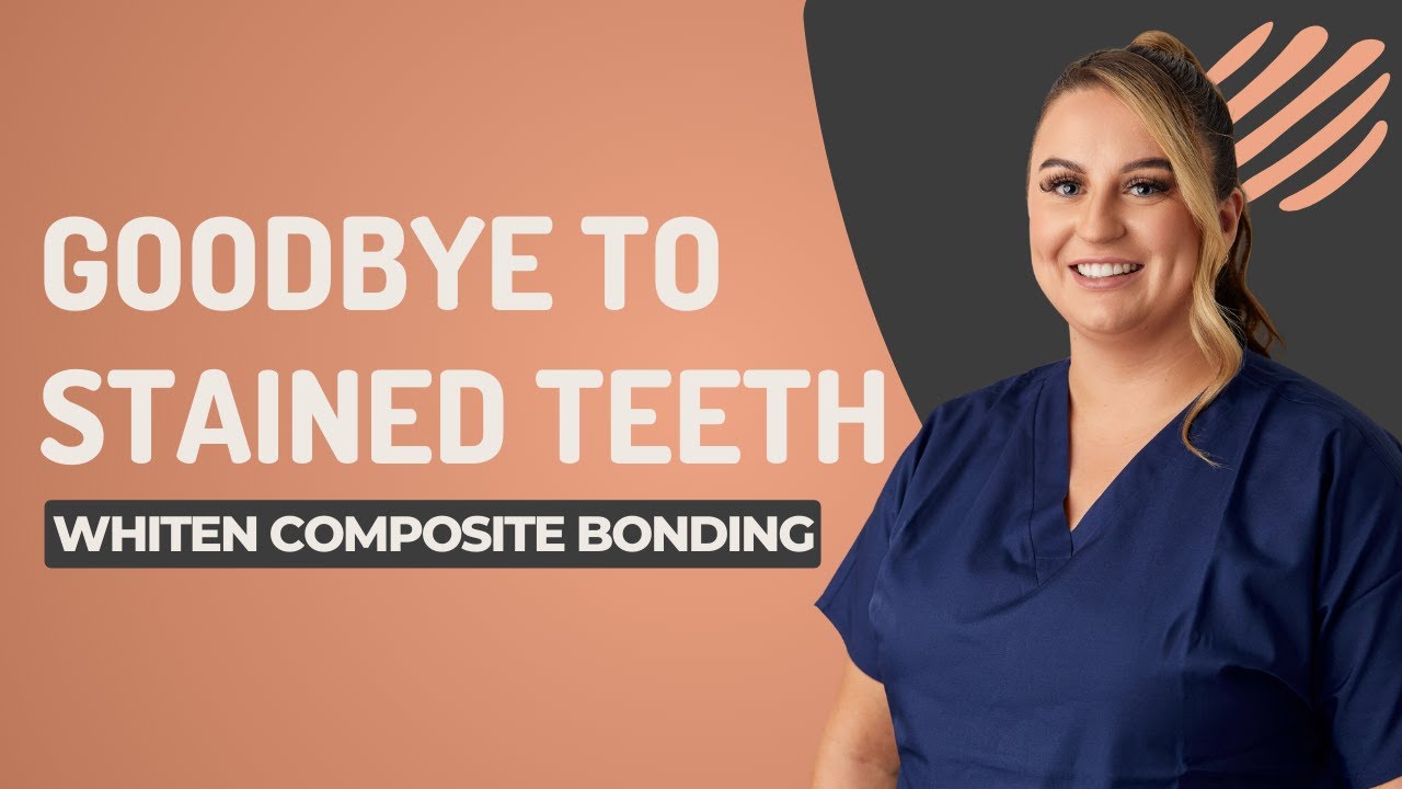 How to whiten composite bonding? Can you use Teeth Whitening to whiten?