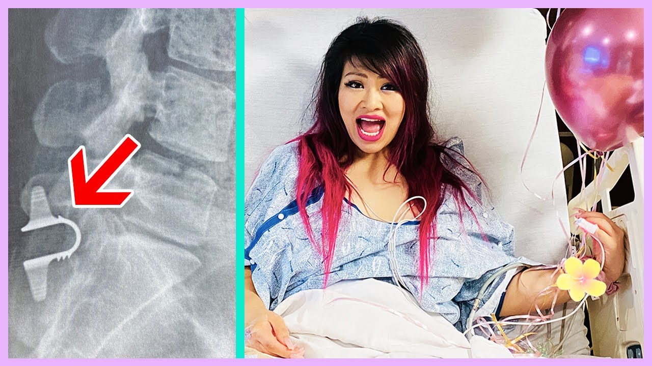 I BROKE MY BACK! SURGERY VLOG