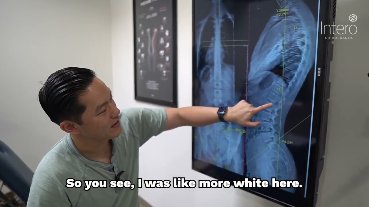 Lifting Weights Injury: chiropraccitc helps
