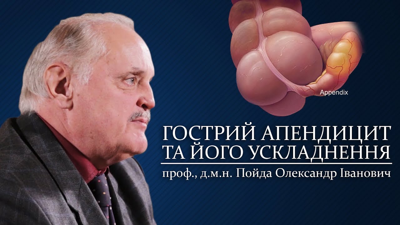 Відеолекція ГОСТРИЙ АПЕНДИЦИТ. Пойда О.І.