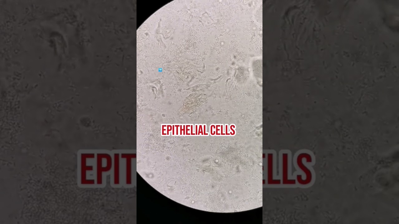 Urine sediments under the microscope #laboratory #microscope #underthemicroscope