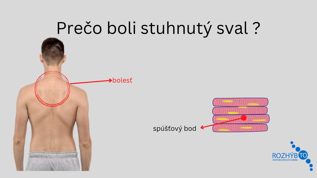 Ako sa zbaviť stuhnutosti svalu a prečo stuhnutý sval boli ? 🤔