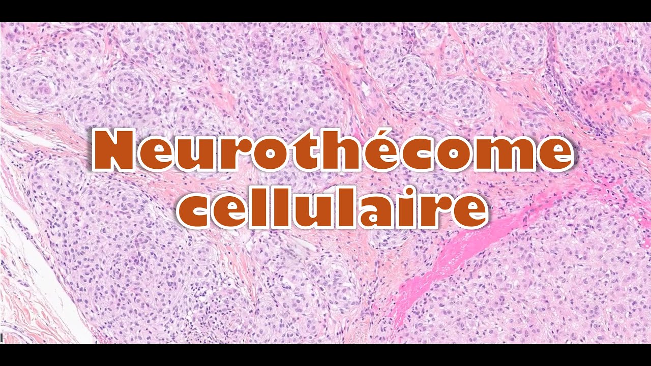 Neurothécome cellulaire