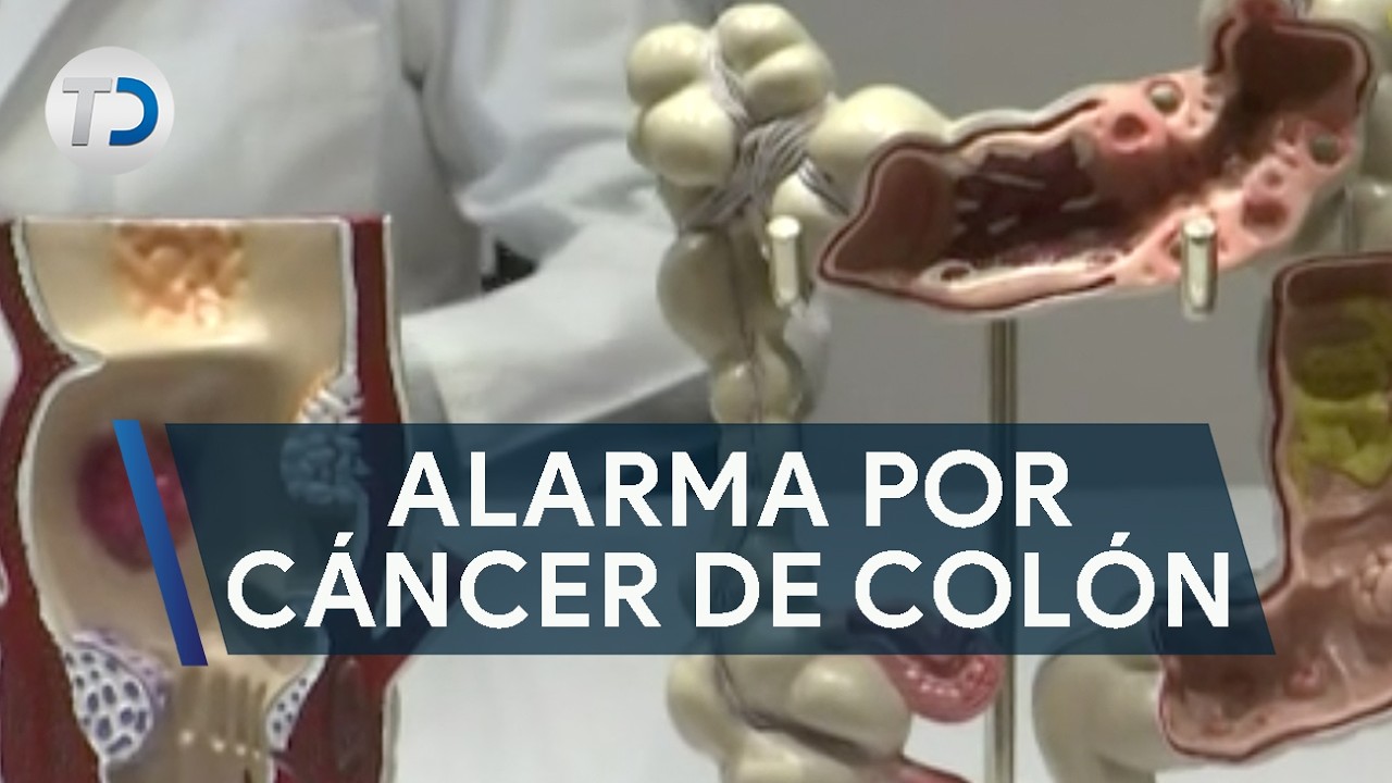 Las causas del cáncer de colón: enfermedad letal en la región