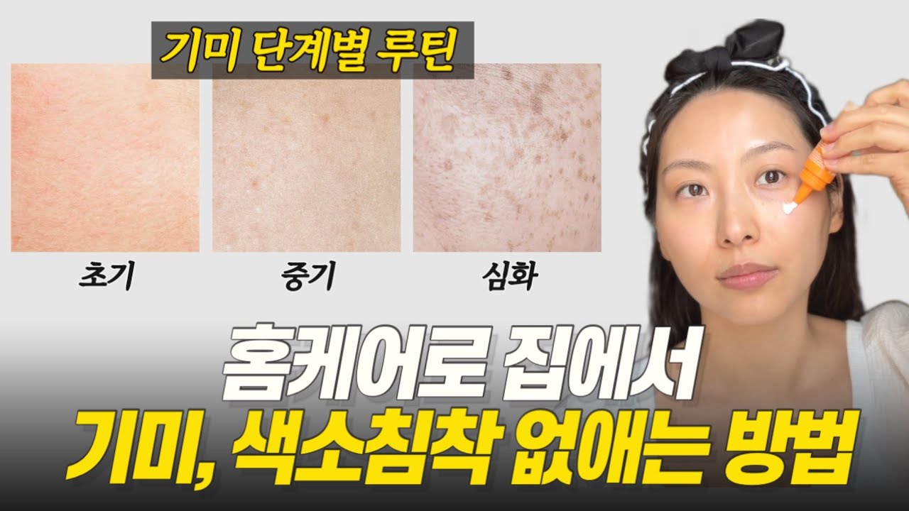기미가 하나라도 보인다면 꼭 봐야하는 영상